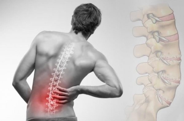 HỘI CHỨNG ĐAU CẤP TẠI C&Aacute;C V&Ugrave;NG VAI, G&Aacute;Y V&Agrave; THẮT LƯNG TR&Ecirc;N CƠ THỂ