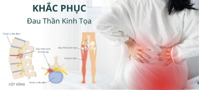 🔻NGUY&Ecirc;N NH&Acirc;N ĐAU THẦN KINH TỌA, L&Agrave;M SAO ĐỂ KHẮC PHỤC